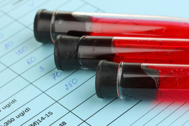 Prekinuto istraživanje vakcine protiv HIV-a
